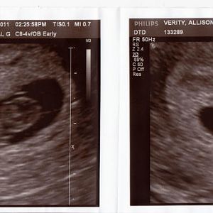 8 weeks 1 day